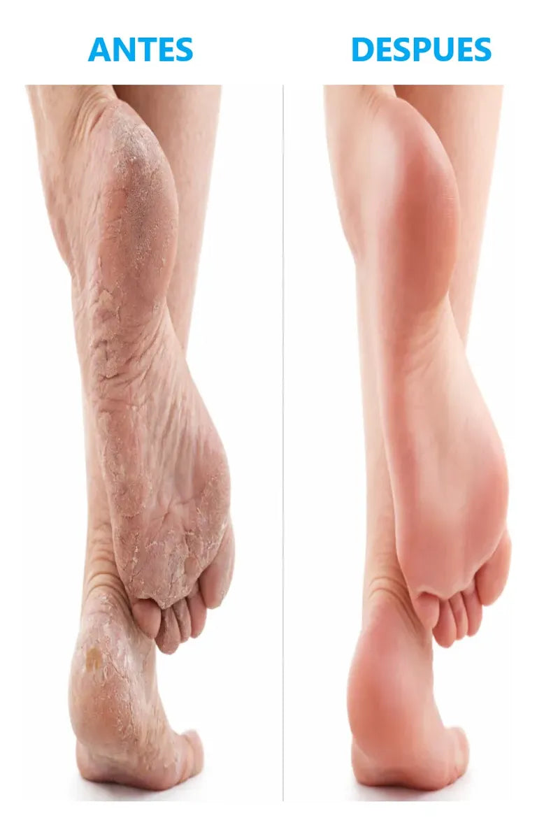 Máscara Renovadora para Pies con Colágeno – Efecto Peeling